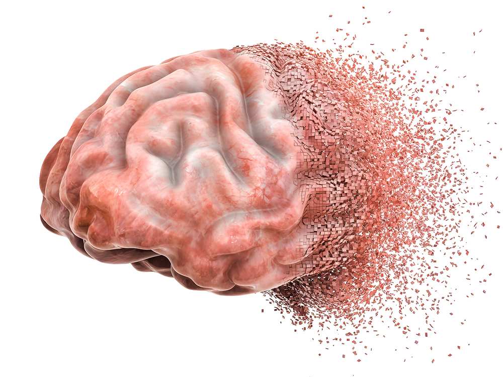 Proving a Traumatic Brain Injury Claim