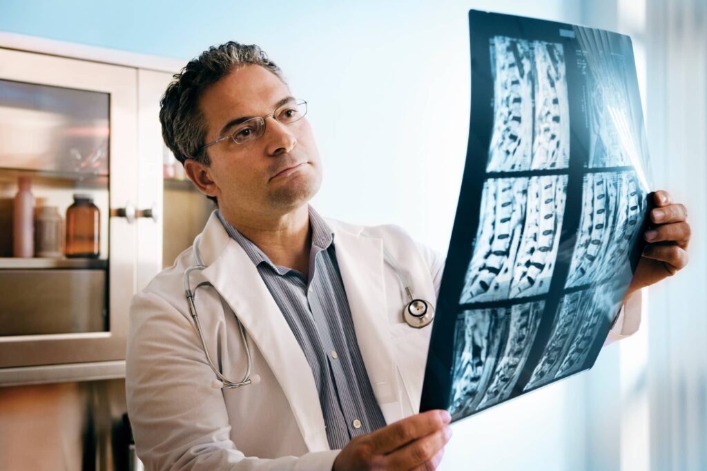 Médico observando una resonancia magnética de la médula espinal.